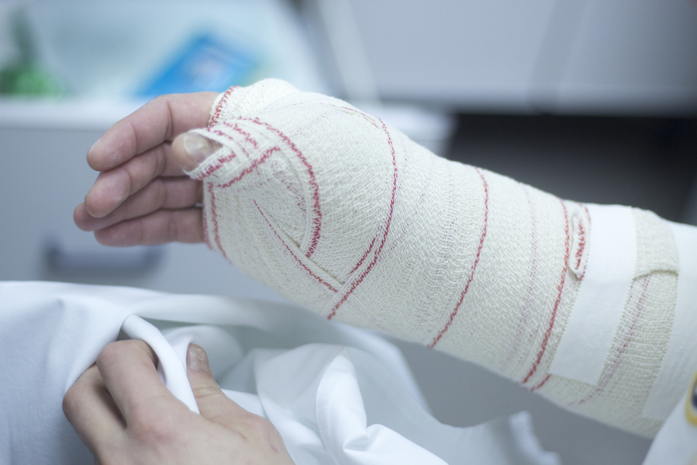 Fractures & Accidents | New York Personal Injury Attorney | Vrionedes