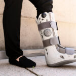 Businesswoman with an ankle brace stands on a sidewalk, showing strength and determination in her recovery journey